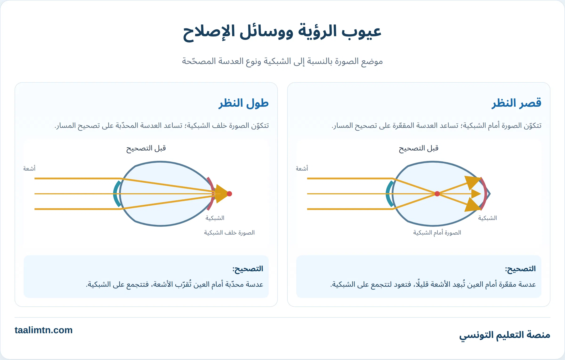 رسم توضيحي لعيوب الرؤية قصر النظر وطول النظر وكيفية إصلاحها بالعدسات